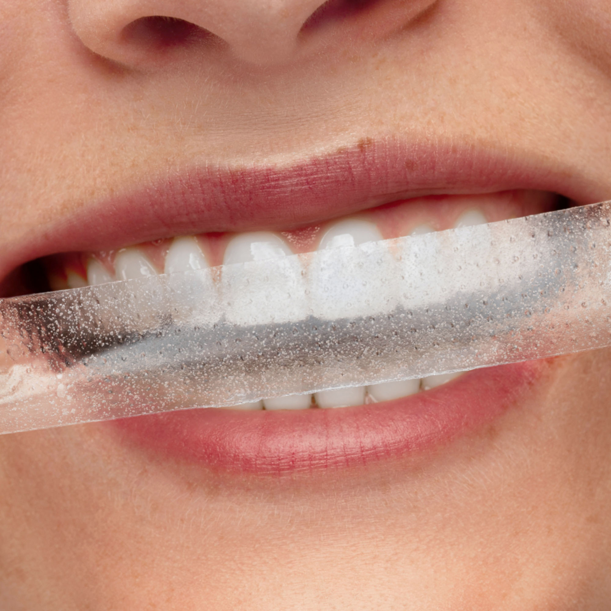 SmilePen Power Whitening Strips 2 Stk