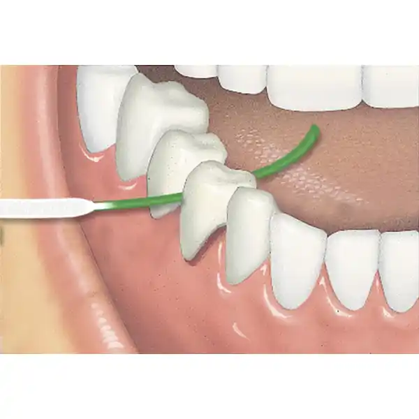 ACCESS FLOSS Zahnseide mit Einfädelhilfe für 50 Anwendungen