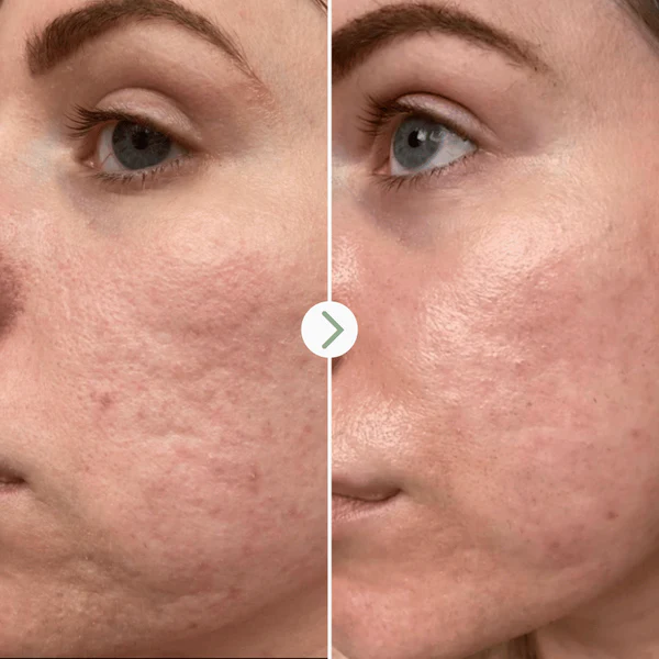 Pai skincare Booster Hydratant - Acide Hyaluronique 10ml