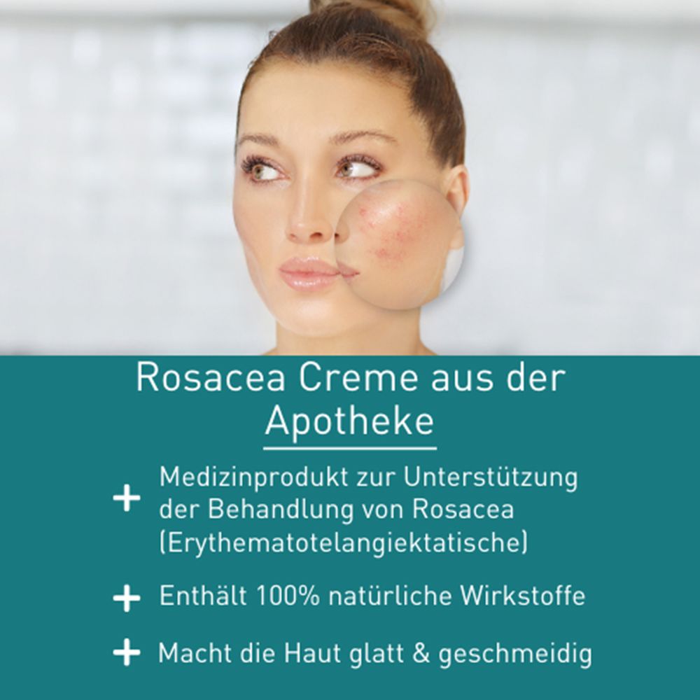 N1 Rosacea Crème – beruhigt und lindert Rötungen und Juckreiz