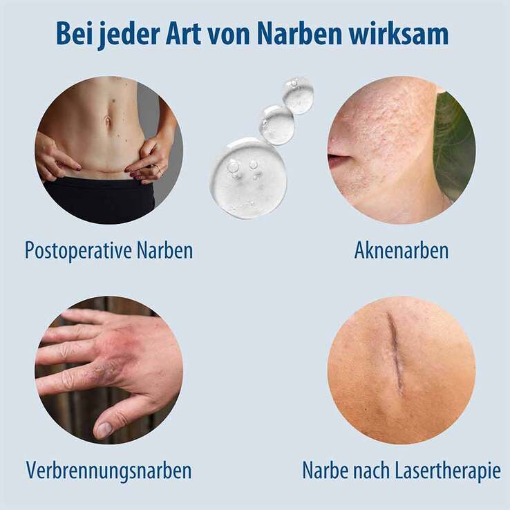 Evolsin Narben Gel, 20 g
