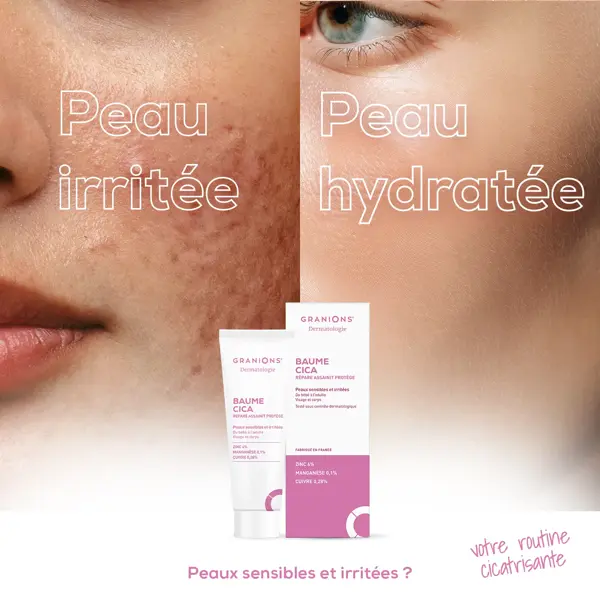 Bálsamo Cicatrizante GRANIONS CICA - Bebês e Adultos - Rosto e Corpo 40ml