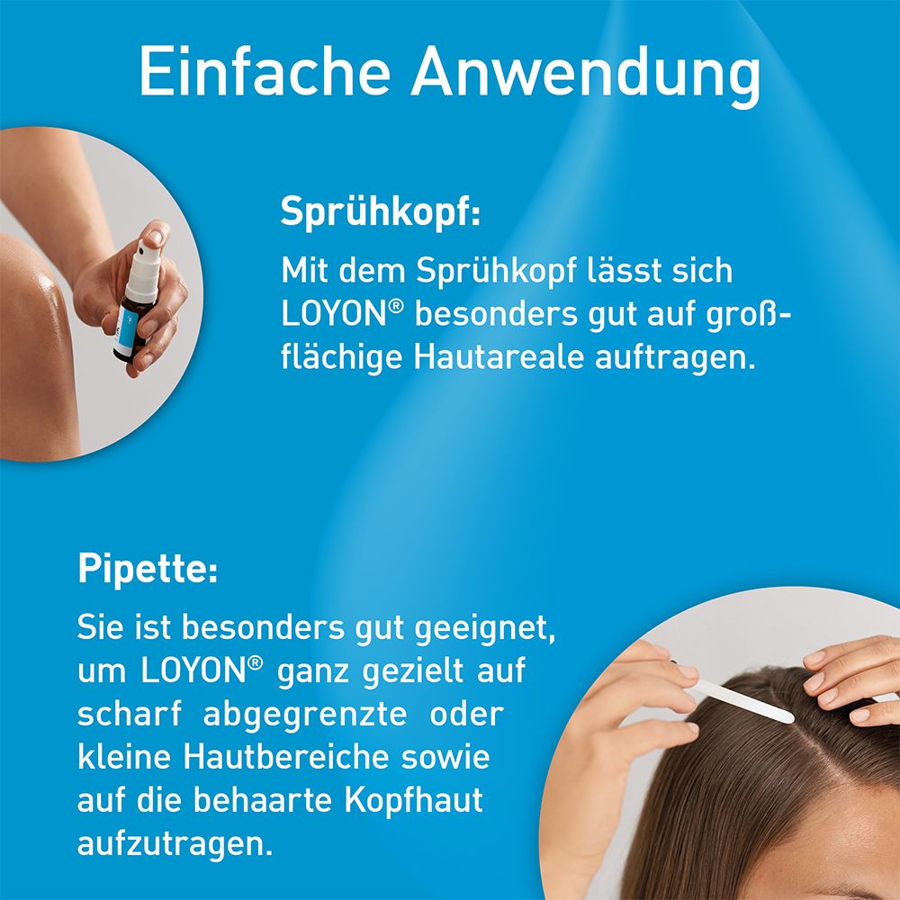 LOYON bei Schuppenflechte, Milchschorf und Kopfgneis 15ml Lösung