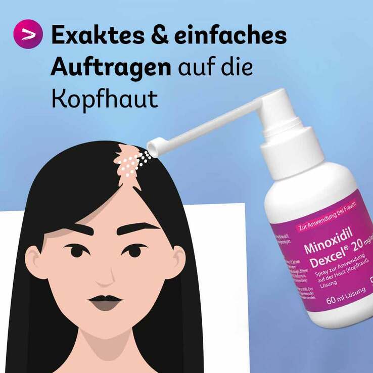 Minoxidil Dexcel 20 mg / ml Spray z.Anw.a.d.Kopfhaut, 3X60 ml