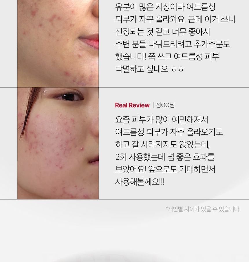 medicube - Rode Acne Succinezuur Peel
