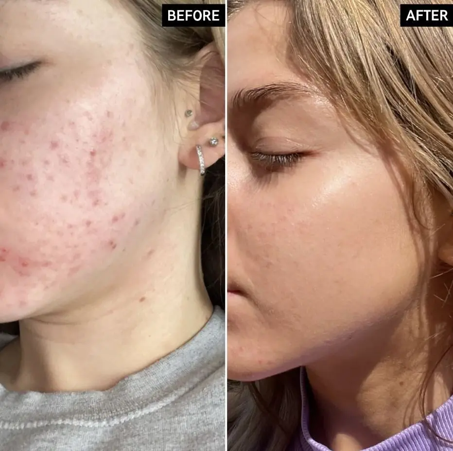 Niacinamide Serum