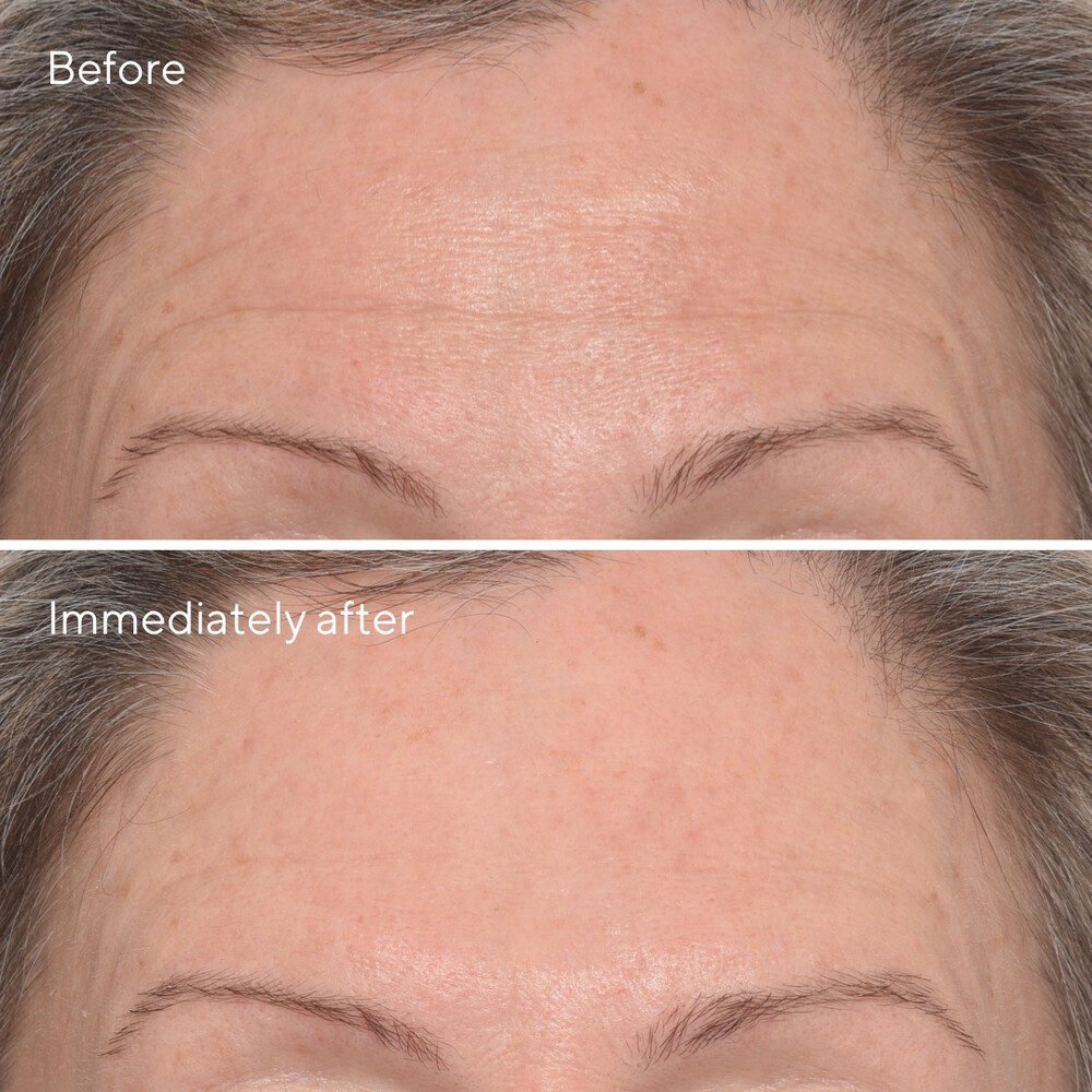 Murad Skincare Resurgence Targeted Wrinkle Corrector15 ml