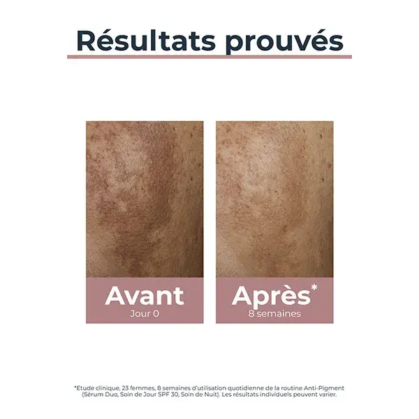 Eucerin Anti-Pigment Soin de Nuit Anti-Taches 50ml