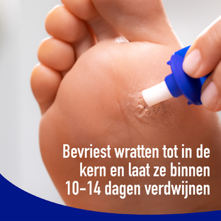 Wartner Wrattenverwijderaar Hand & Voet 50ML
