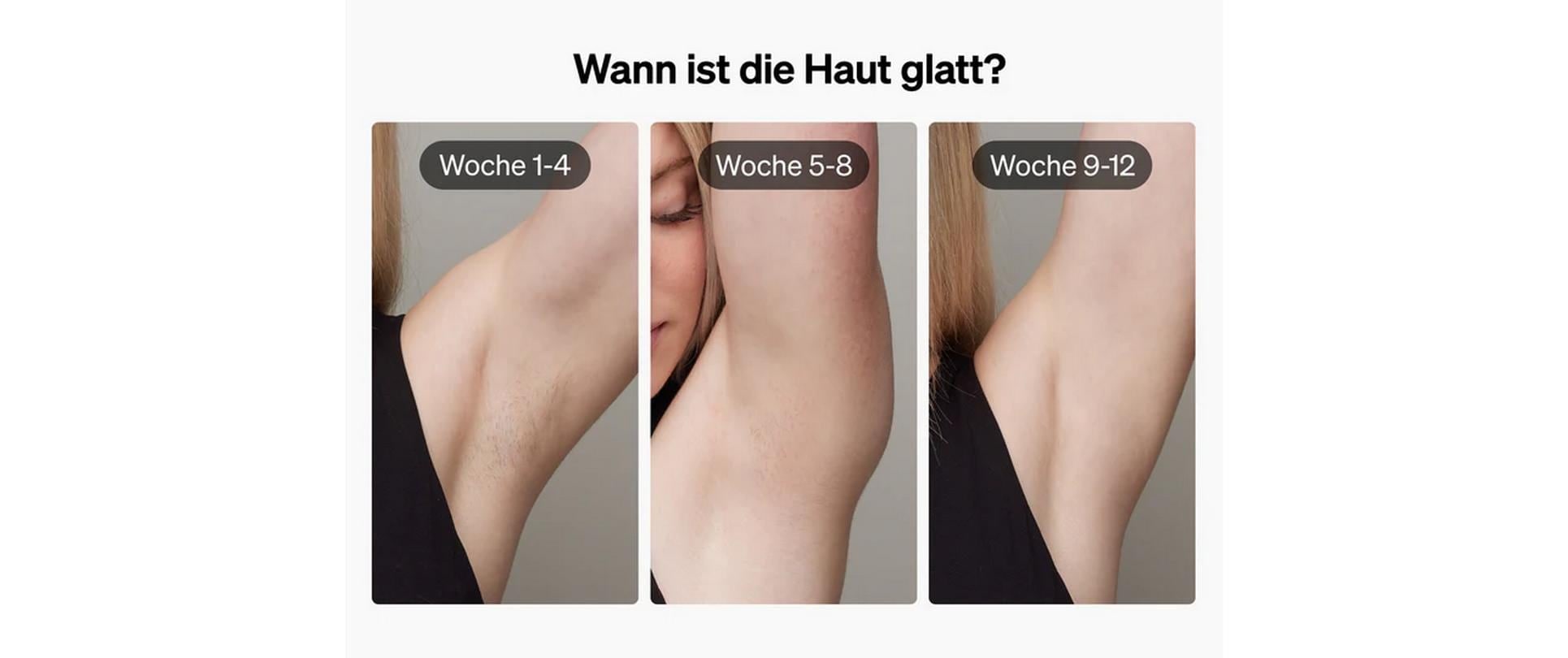 IPL-Haarentferner »Ulike Air 3« 1000000 Lichtimpulse