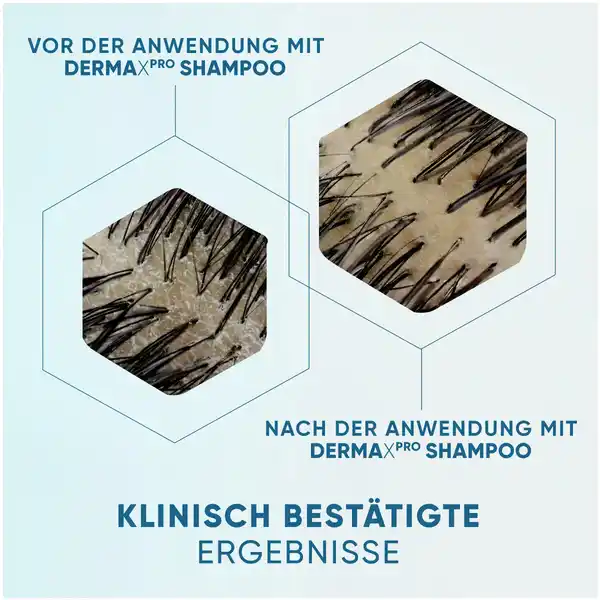 DERMAXPRO Beruhigend Anti-Schuppen Shampoo