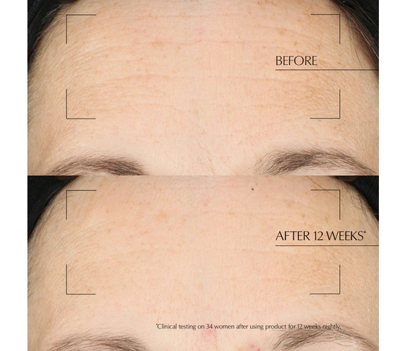Estée Lauder Advanced Night Repair Overnight Treatment