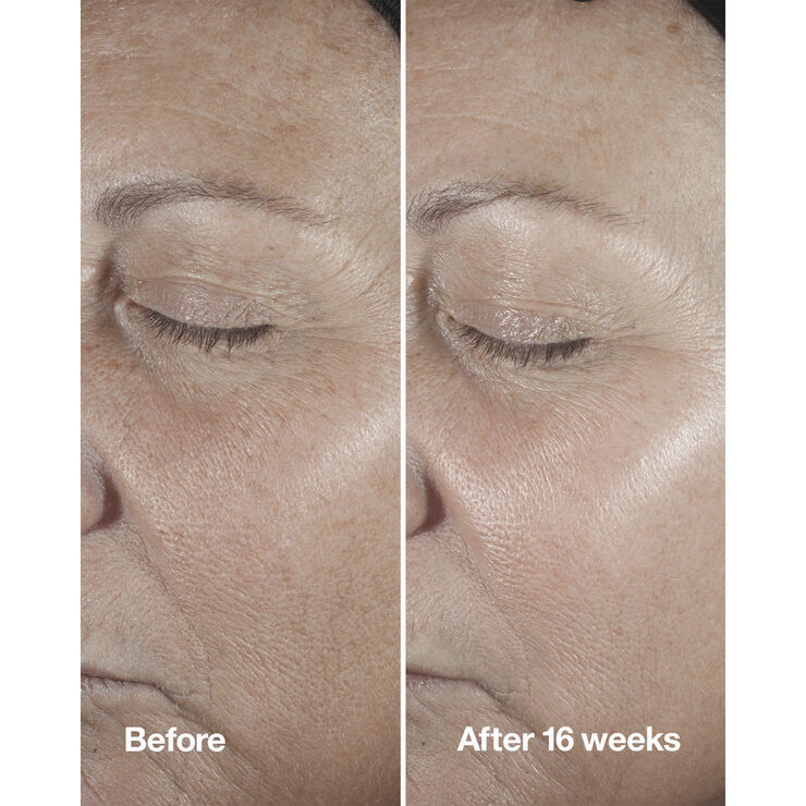 Clinique Smart Clinical Repair Wrinkle Correcting Serum