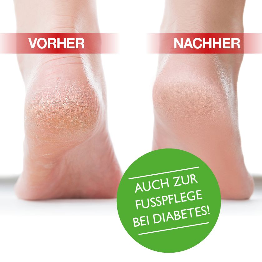 Lasepton® FUSS-CREME
