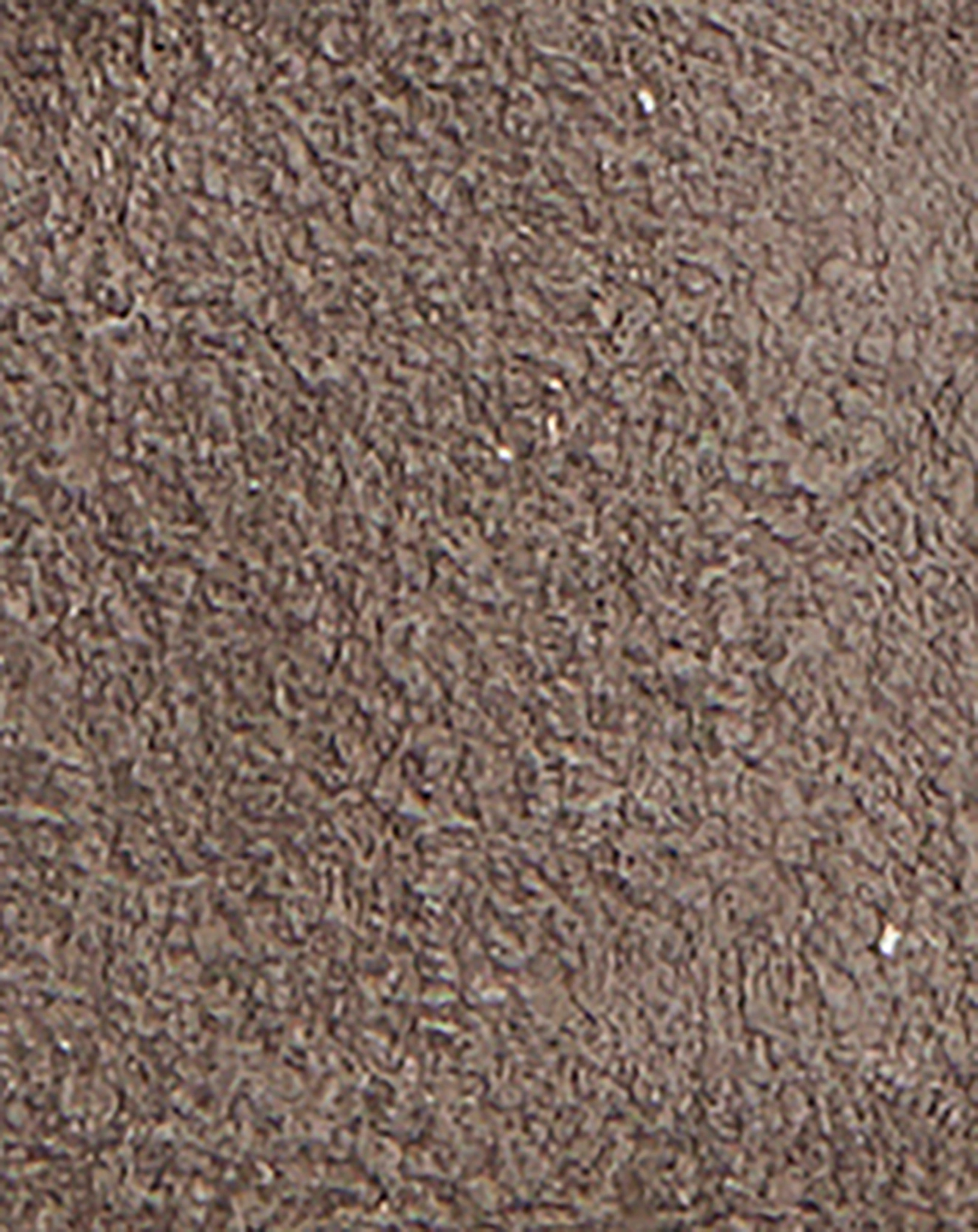 Krabbelschuhe RACOON in chocolate chip