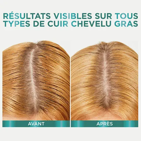 Shampoo Purificante L'Oréal Paris Elseve Hyaluron Pure 72H 300ml