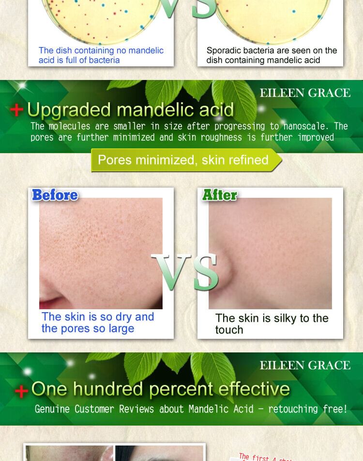 EILEEN GRACE - Flawless White Mandelic Acid Renewal Essence
