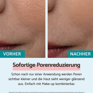 REMESCAR Sofortige Porenreduzierung, 20 ml