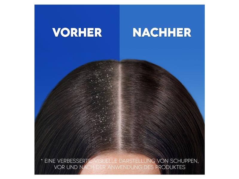 head and shoulders Shampoo Anti-Schuppen apple fresh 500 ml Hochwertiges Haarshampoo für gesunde Haare