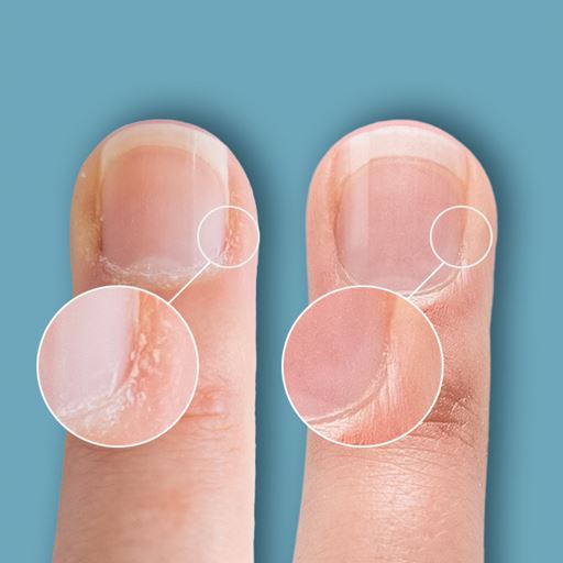 CND Cuticle Eraser