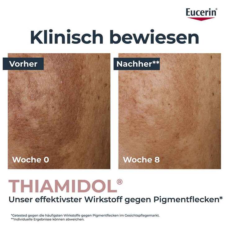 Eucerin Anti-Pigment Teint perfektionierendes Serum, 30 ml