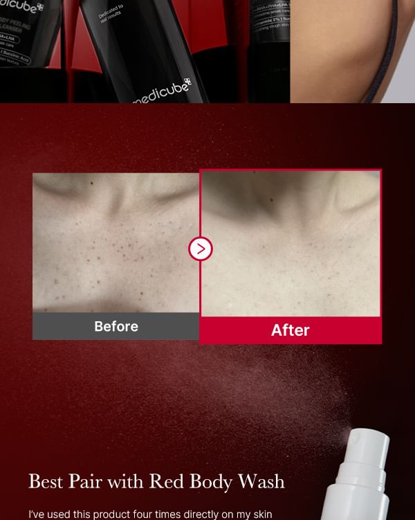 medicube - Rode acne lichaamspeeling shot