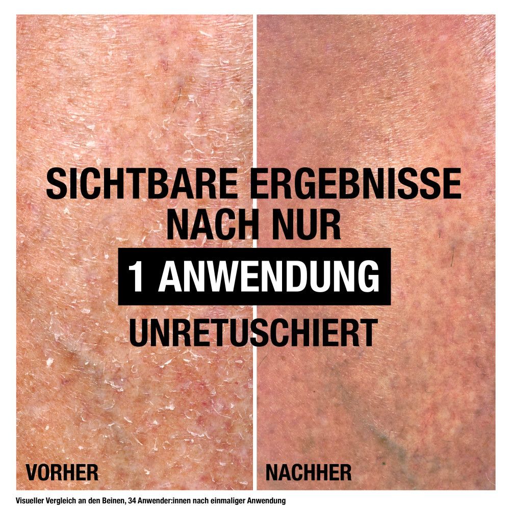Neutrogena Norwegische Formel Intense Repair Reparierender CICA Bodybalsam (250 ml) für eine sofortige Linderung & mehr Feuchtigkeit bei sehr trockener, rauer Haut
