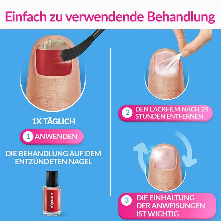 Excilor Nagelpilz intensiv Color 30 ml + 8 ml Kombi., 1 P