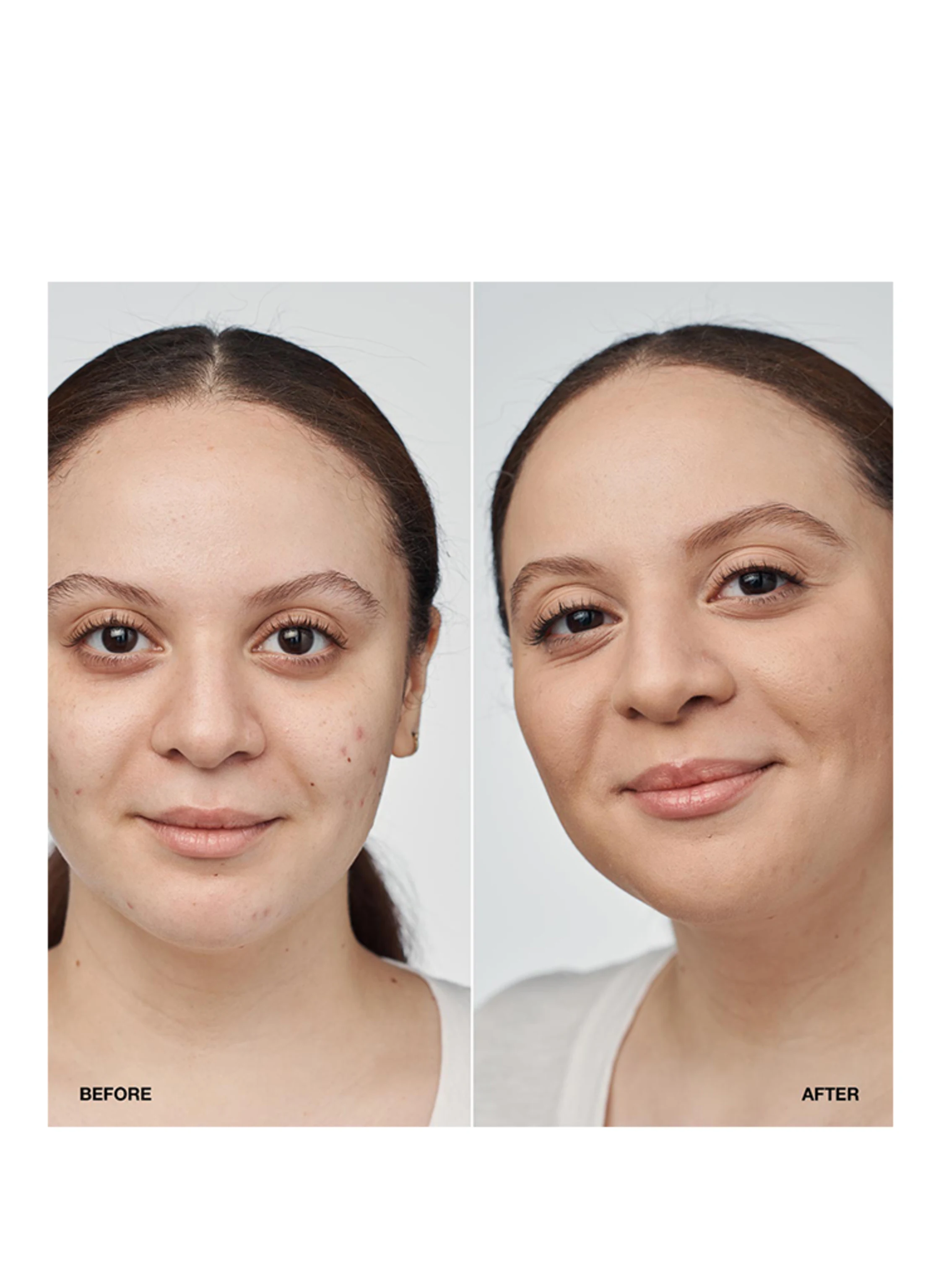 CLINIQUE EVEN BETTER CLINICAL