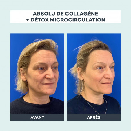 D-LAB NUTRICOSMETICS Detox microcirculation 1 mois