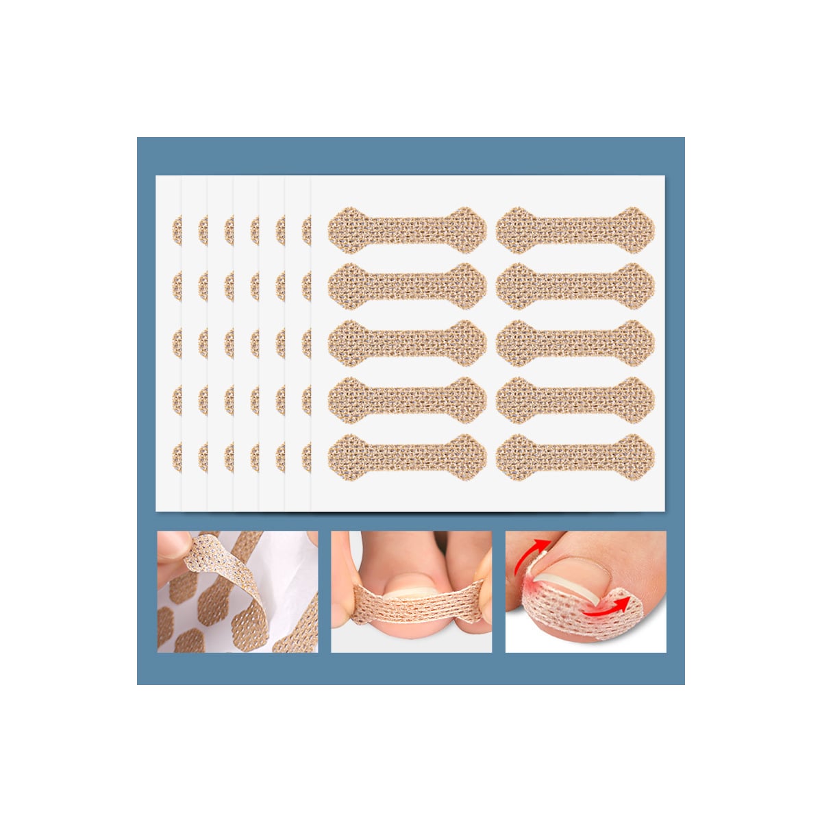 Gips for inngrodde tånegler Beige
