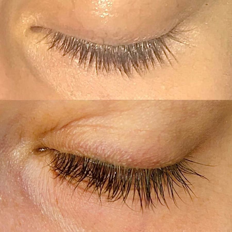 Lenoites ® Eyelash Activating Serum 5ml