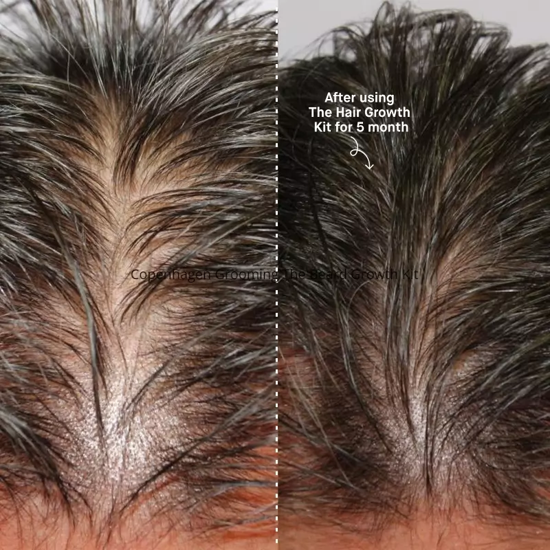 Copenhagen Grooming The Hair Growth Kit