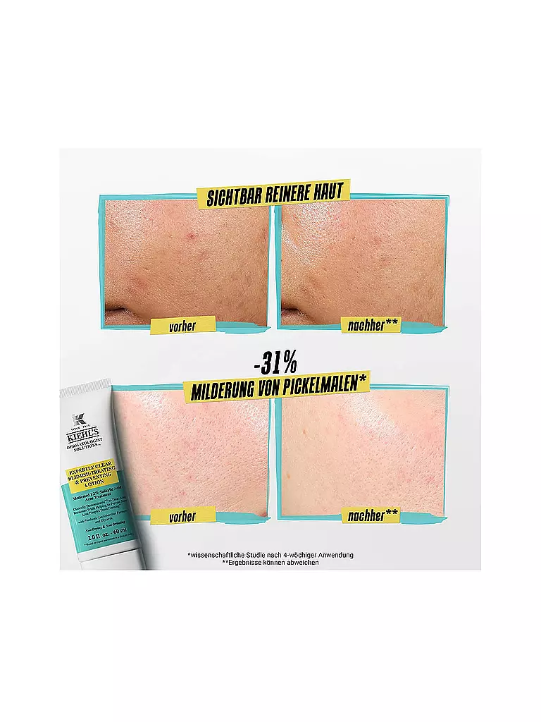 KIEHL'S Gesichtscreme - Expertly Clear Blemish Treating & Preventing Lotion 60ml keine Farbe