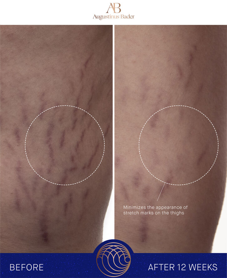 Augustinus Bader The Body Cream