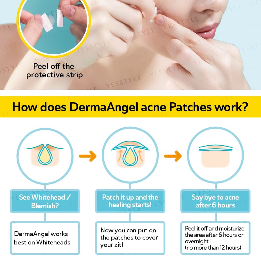 DermaAngel - Dagpleister tegen acne, 24 stuks