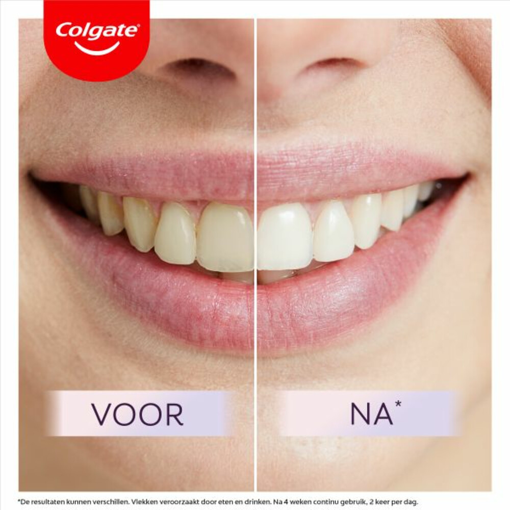 Colgate Tandpasta Max White Ultimate75 ml