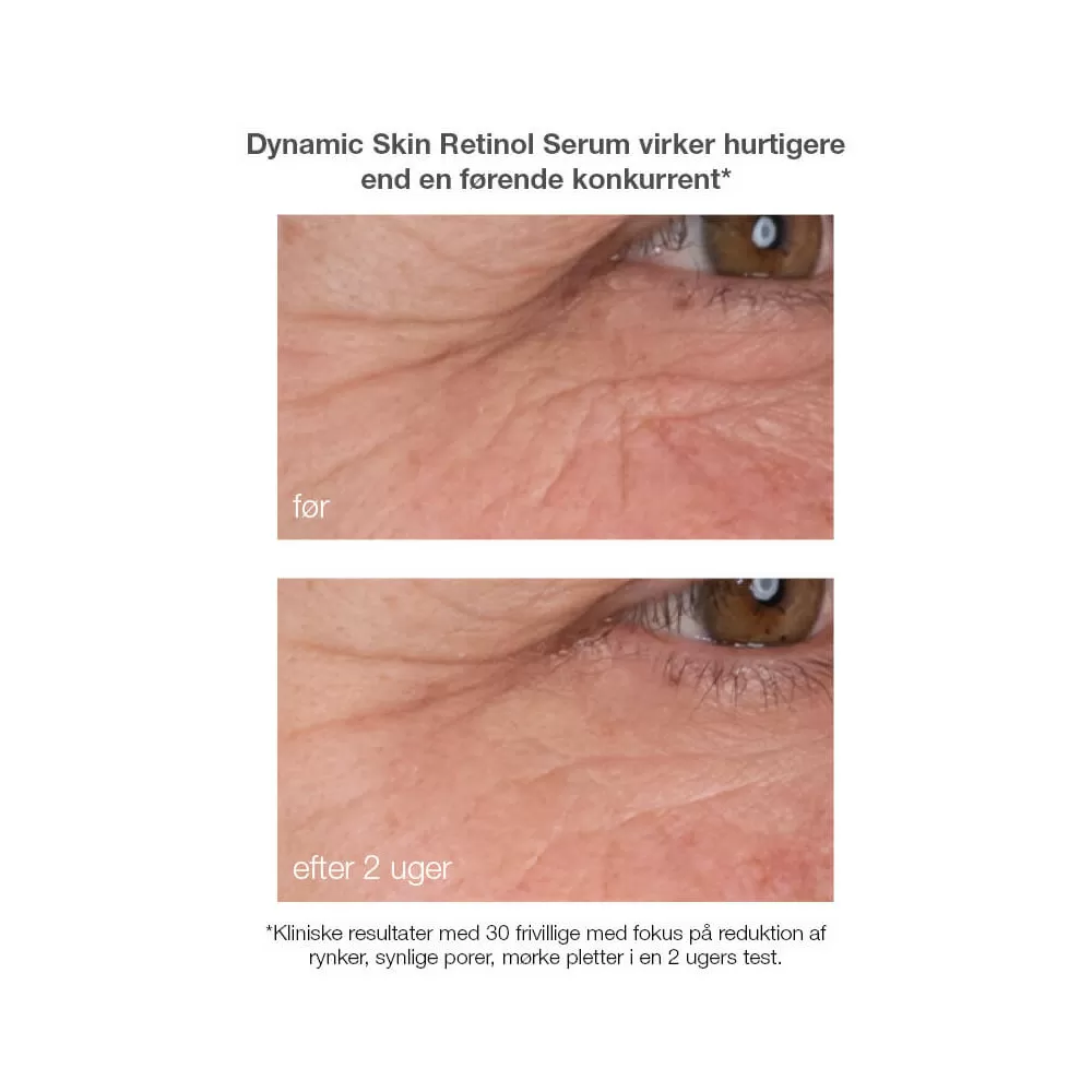 Dermalogica Dynamic Skin Retinol Serum - 30ml.