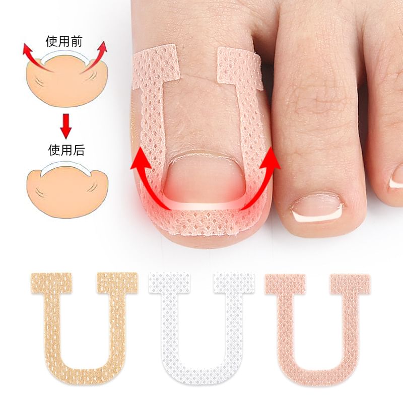 HATHA - Sticker voor correctie van ingegroeide teennagels