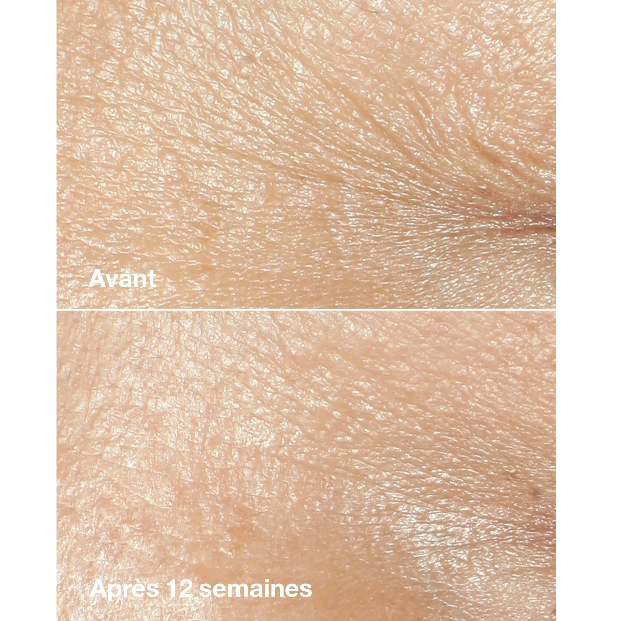 Smart Clinical Repair - Crème correctrice anti-rides |
