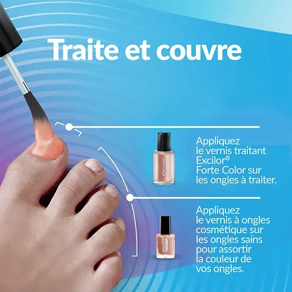 Excilor Solution Forte Color Traitement Mycose de l'Ongle