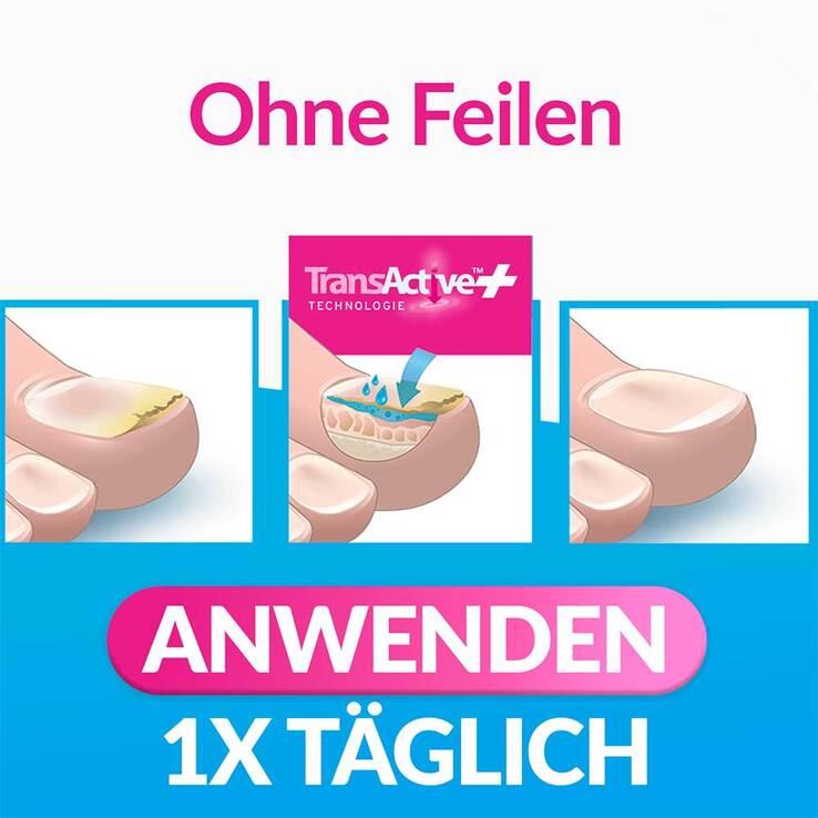 excilor INTENSIV Lack gegen Nagelpilz, 30 ml