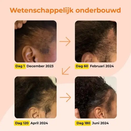 Rozemarijn Olie