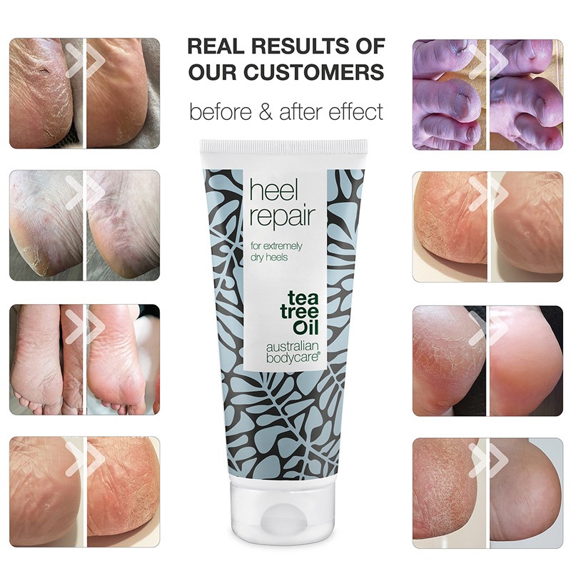 Australian Bodycare Heel Repair 100 ml