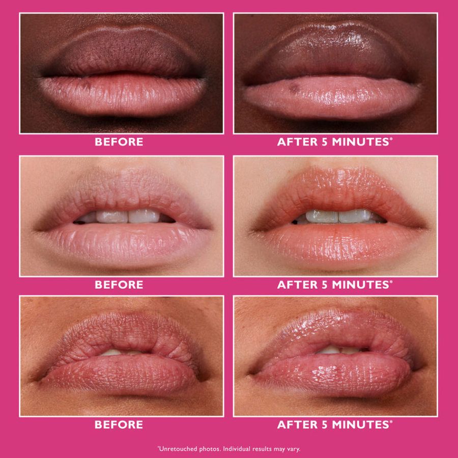 Peter Thomas Roth Instant FIRMx Lip Filler 10ml