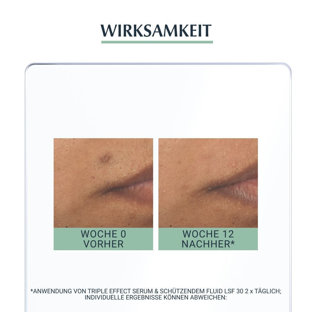 Eucerin® DermoPure Triple Effect Serum – Gesichtsserum gegen unreine Haut, Pickelmale und glänzende Haut, nicht komedogen