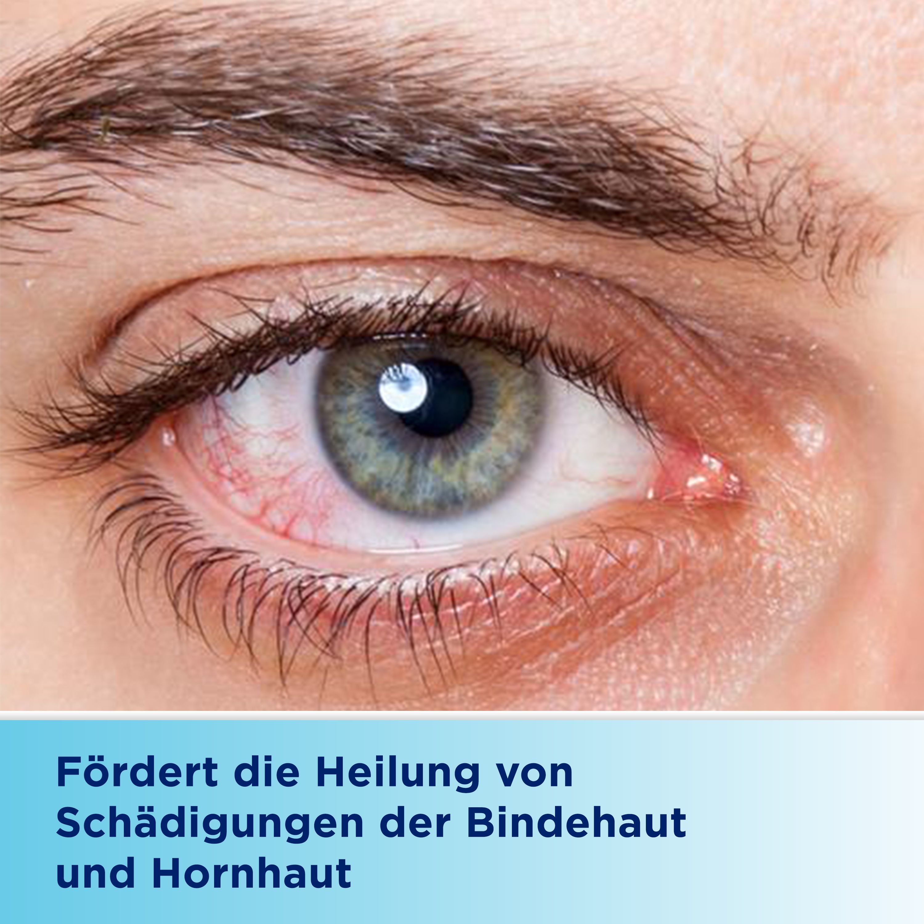 Bepanthen® Augen- und Nasensalbe