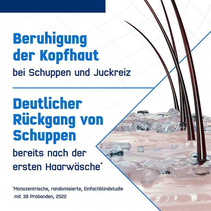 Terzolin Expert Shampoo bei fettiger Kopfhaut, 200 ml