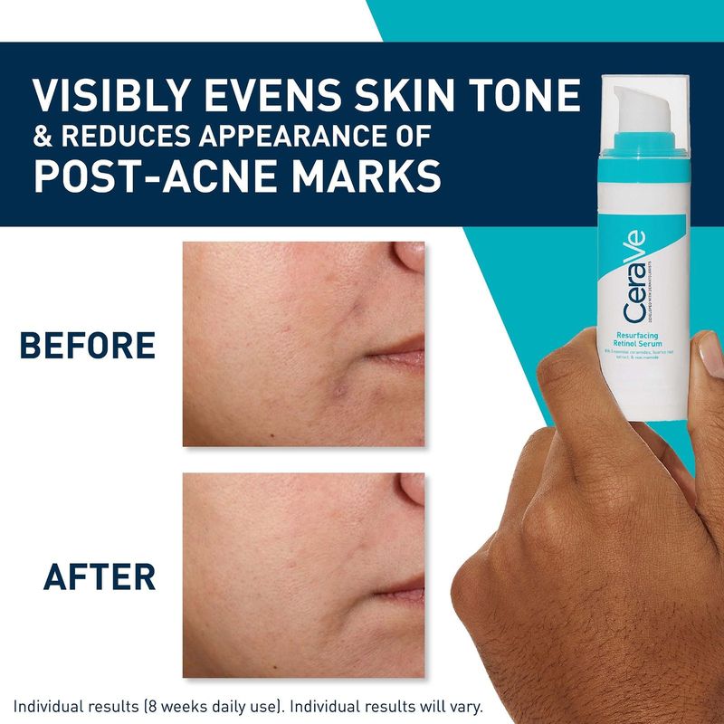 CeraVe - Retinol Serum - Gezichtsserum - 30ml