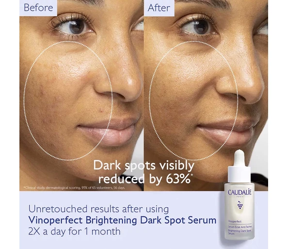 CAUDALIE Vinoperfect Brightening Dark Spot Serum